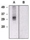 Chloride intracellular channel protein 5 antibody, AM26766RP-N, Origene, Western Blot image 