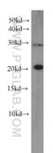 RB Binding Protein 9, Serine Hydrolase antibody, 66015-1-Ig, Proteintech Group, Western Blot image 