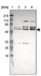 Protein DGCR14 antibody, PA5-51543, Invitrogen Antibodies, Western Blot image 