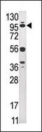 Ubiquitin Specific Peptidase 1 antibody, 61-091, ProSci, Western Blot image 