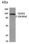 CD163 antibody, GTX52614, GeneTex, Western Blot image 
