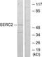 Serine Incorporator 2 antibody, TA316384, Origene, Western Blot image 