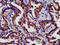 Protein phosphatase Slingshot homolog 3 antibody, LS-C674183, Lifespan Biosciences, Immunohistochemistry paraffin image 