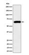 Sequestosome 1 antibody, M00300-3, Boster Biological Technology, Western Blot image 