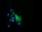 Epoxide Hydrolase 2 antibody, NBP2-02948, Novus Biologicals, Immunocytochemistry image 