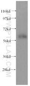 FLT3 Interacting Zinc Finger 1 antibody, 15827-1-AP, Proteintech Group, Western Blot image 