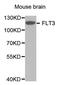 Fms Related Tyrosine Kinase 3 antibody, STJ23675, St John