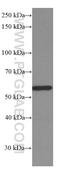 Rho GDP-dissociation inhibitor 1 antibody, 66434-1-Ig, Proteintech Group, Western Blot image 