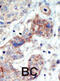 EPH Receptor B3 antibody, abx033535, Abbexa, Immunohistochemistry paraffin image 