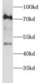 RIO Kinase 1 antibody, FNab07310, FineTest, Western Blot image 