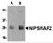 Nipsnap Homolog 2 antibody, 4943, ProSci, Western Blot image 