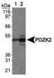 PDZ Domain Containing 3 antibody, PA3-16819, Invitrogen Antibodies, Western Blot image 