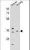 Potassium Channel Regulator antibody, LS-C165448, Lifespan Biosciences, Western Blot image 