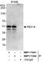 Peroxisomal membrane protein PEX14 antibody, NBP1-71841, Novus Biologicals, Western Blot image 