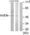 Cell death regulator Aven antibody, TA315642, Origene, Western Blot image 
