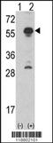 Inhibin Subunit Alpha antibody, 62-429, ProSci, Immunohistochemistry paraffin image 