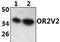 Olfactory Receptor Family 2 Subfamily V Member 2 antibody, PA5-75955, Invitrogen Antibodies, Western Blot image 