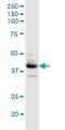 Beta-1,4-Galactosyltransferase 3 antibody, H00008703-D01P, Novus Biologicals, Western Blot image 