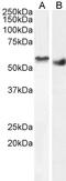 Serine/Threonine Kinase 35 antibody, 46-445, ProSci, Enzyme Linked Immunosorbent Assay image 