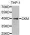 Creatine kinase M-type antibody, A2024, ABclonal Technology, Western Blot image 