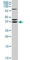 Short Chain Dehydrogenase/Reductase Family 16C Member 5 antibody, H00195814-M01, Novus Biologicals, Western Blot image 