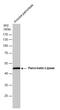 Pancreatic Lipase antibody, GTX632267, GeneTex, Western Blot image 