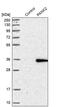 Pantothenate Kinase 2 antibody, PA5-52563, Invitrogen Antibodies, Western Blot image 