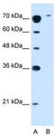 Solute Carrier Family 7 Member 14 antibody, TA333733, Origene, Western Blot image 
