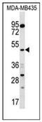 Sorting Nexin 4 antibody, AP53978PU-N, Origene, Western Blot image 