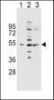 Solute Carrier Family 36 Member 1 antibody, TA324476, Origene, Western Blot image 