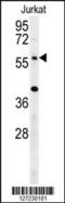 Tripartite Motif Containing 50 antibody, 61-996, ProSci, Western Blot image 