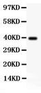 Transcription Factor AP-2 Alpha antibody, LS-C343980, Lifespan Biosciences, Western Blot image 