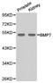 Bone Morphogenetic Protein 7 antibody, TA326853, Origene, Western Blot image 