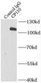 Centrosomal protein CP110 antibody, FNab01915, FineTest, Immunoprecipitation image 