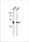 TATA-Box Binding Protein Associated Factor 7 antibody, TA324561, Origene, Western Blot image 