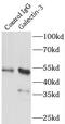 MAC2 antibody, FNab03316, FineTest, Immunoprecipitation image 