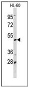 Decapping MRNA 2 antibody, AP51202PU-N, Origene, Western Blot image 