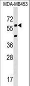 Potassium Voltage-Gated Channel Modifier Subfamily S Member 3 antibody, LS-C159981, Lifespan Biosciences, Western Blot image 