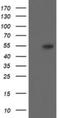 Diphthamide Biosynthesis 2 antibody, NBP2-46475, Novus Biologicals, Western Blot image 