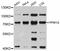 Protein Phosphatase, Mg2+/Mn2+ Dependent 1G antibody, abx126402, Abbexa, Western Blot image 