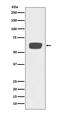 Plasminogen Activator, Tissue Type antibody, M02965, Boster Biological Technology, Western Blot image 