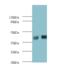 Sex Hormone Binding Globulin antibody, MBS1488811, MyBioSource, Western Blot image 