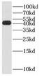 Required For Meiotic Nuclear Division 5 Homolog B antibody, FNab07322, FineTest, Western Blot image 