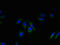 Neuropeptides B And W Receptor 2 antibody, orb25140, Biorbyt, Immunocytochemistry image 