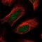 Thioesterase Superfamily Member 5 antibody, NBP1-81943, Novus Biologicals, Immunofluorescence image 