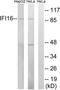 Gamma-interferon-inducible protein 16 antibody, TA314052, Origene, Western Blot image 