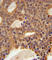 DNA Cross-Link Repair 1B antibody, abx032517, Abbexa, Western Blot image 