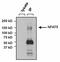 Nuclear factor of activated T-cells 5 antibody, PA1-023, Invitrogen Antibodies, Immunoprecipitation image 