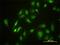 Serine/Threonine Kinase 4 antibody, H00006789-M01, Novus Biologicals, Immunocytochemistry image 