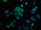Aldo-keto reductase family 1 member C1 antibody, LS-C670975, Lifespan Biosciences, Immunofluorescence image 